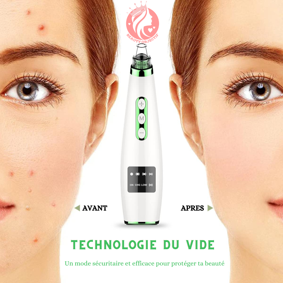 ASPIRATEUR DE POINTS NOIRS⎮BLACKHEAD REMOVER™