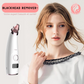 ASPIRATEUR DE POINTS NOIRS⎮BLACKHEAD REMOVER™